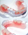 Foto: Mecanica dental 